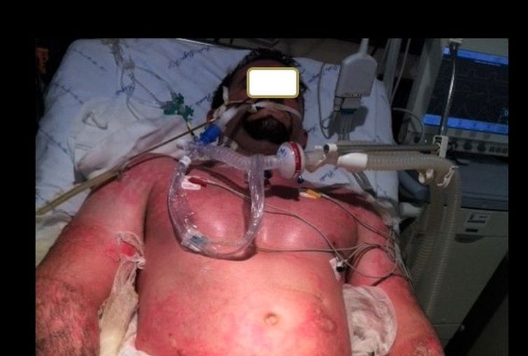 Centro de atendimento integrado do Hospital Universitário de Santa Maria  à vítimas de acidentes que atendem sobreviventes da  tragédia da boate Kiss.